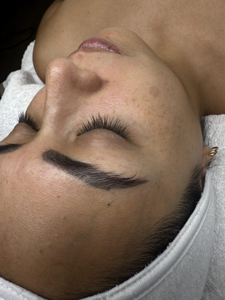 dark spots guatemala