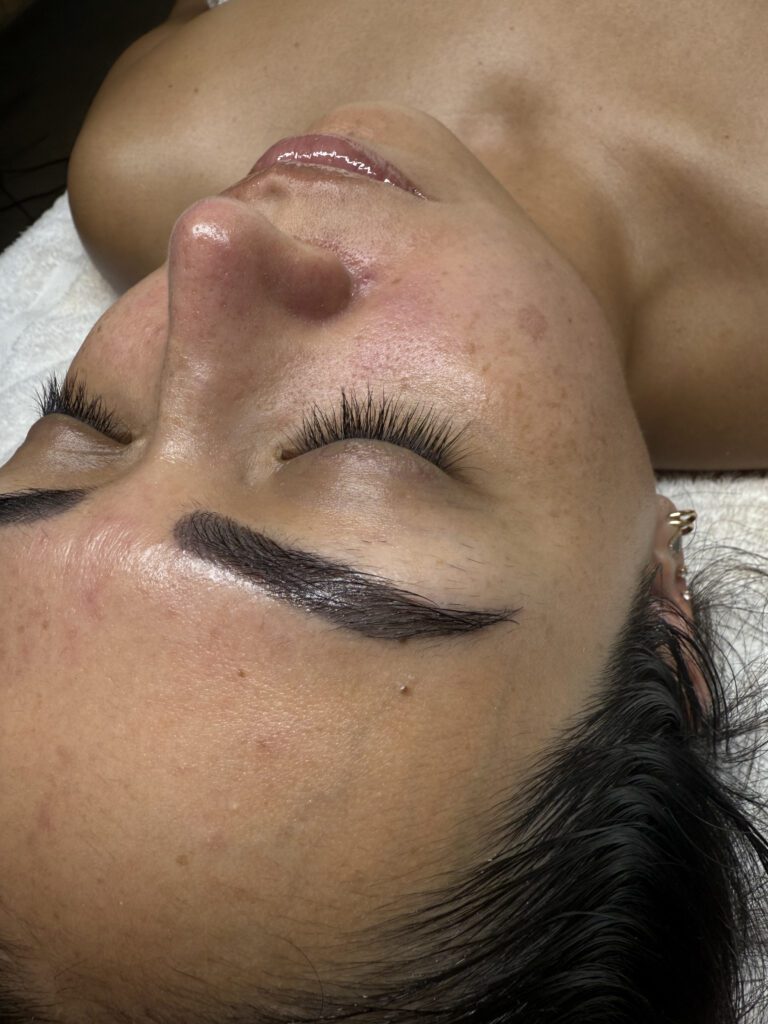 dark spots guatemala